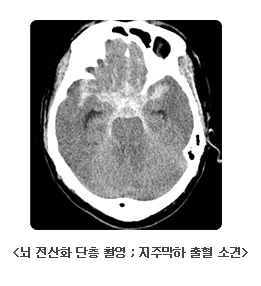 분당차병원 신경외과 ::::::::::::::::::